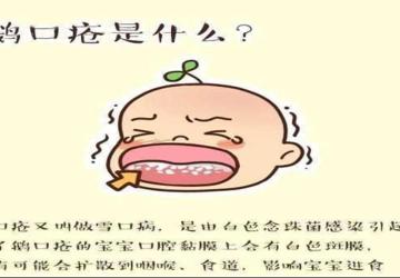 宝宝嘴里有白斑？当心鹅口疮！——新手爸妈必看